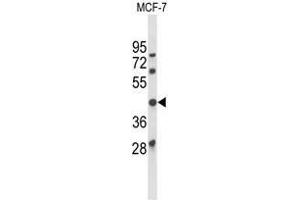Western blot analysis of ATXN3 Antibody (Center) in MCF-7 cell line lysates (35µg/lane). (Ataxin 3 Antikörper  (Middle Region))