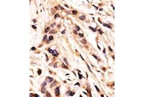 Image no. 2 for anti-Retinoblastoma 1 (RB1) (pSer608) antibody (ABIN358211) (Retinoblastoma 1 Antikörper  (pSer608))