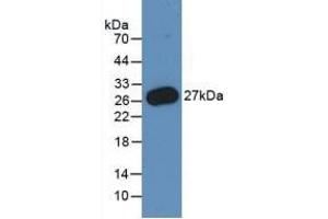 Detection of Recombinant PMP22, Human using Monoclonal Antibody to Peripheral Myelin Protein 22 (PMP22) (PMP22 Antikörper  (AA 31-133))