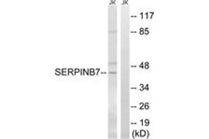 Western Blotting (WB) image for anti-serpin Peptidase Inhibitor, Clade B (Ovalbumin), Member 7 (SERPINB7) (AA 111-160) antibody (ABIN2890627) (SERPINB7 Antikörper  (AA 111-160))
