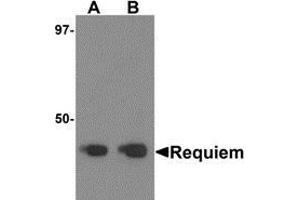 Western blot analysis of Requiem in mouse kidney tissue lysate with Requiem antibody at 1 μg/ml. (DPF2 Antikörper  (C-Term))