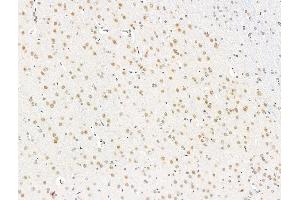 ABIN7094825 and ABIN7098876 at 1/100 staining Rat brain tissue by IHC-P. (RECQL5 Antikörper  (C-Term))