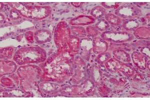 Human Kidney: Formalin-Fixed, Paraffin-Embedded (FFPE) (MAD2L1 Antikörper  (AA 1-174))