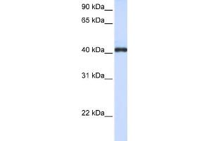 WB Suggested Anti-FCRLA Antibody Titration:  0. (FCRLA Antikörper  (C-Term))