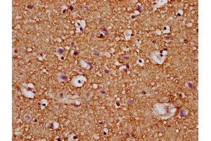 IHC image of ABIN7167153 diluted at 1:200 and staining in paraffin-embedded human brain tissue performed on a Leica BondTM system. (RASAL2 Antikörper  (AA 749-835))