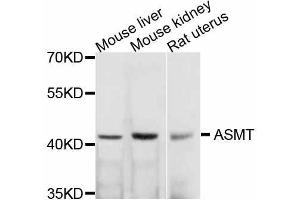 Western blot analysis of extracts of various cell lines, using ASMT antibody (ABIN5999240) at 1/1000 dilution. (ASMT Antikörper)
