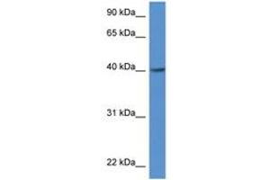 anti-Zinc Finger, DHHC-Type Containing 11 (ZDHHC11) (AA 100-149) antibody