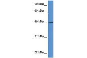 Image no. 1 for anti-Zinc Finger, DHHC-Type Containing 11 (ZDHHC11) (AA 100-149) antibody (ABIN6747230) (ZDHHC11 Antikörper  (AA 100-149))