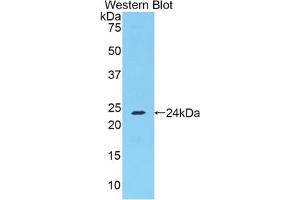 Detection of Recombinant FGA, Mouse using Polyclonal Antibody to Fibrinogen Alpha Chain (FGA) (FGA Antikörper  (AA 357-556))