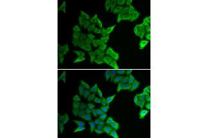 Immunofluorescence analysis of HeLa cells using GJA5 antibody.