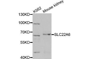 Western Blotting (WB) image for anti-Solute Carrier Family 22 Member 6 (SLC22A6) antibody (ABIN1876924) (SLC22A6 Antikörper)