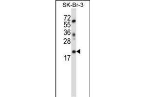 LIN52 Antibody (N-term ) (ABIN657405 and ABIN2846445) western blot analysis in SK-BR-3 cell line lysates (35 μg/lane). (LIN52 Antikörper  (N-Term))