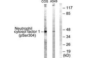 Western blot analysis of extracts from COS7 cells treated with UV 15' and A549 cells, using Neutrophil Cytosol Factor 1 (Phospho-Ser304) Antibody. (NCF1 Antikörper  (pSer304))