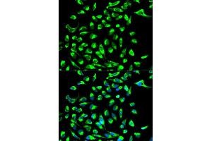 Immunofluorescence analysis of MCF-7 cell using CLDN7 antibody. (Claudin 7 Antikörper  (AA 29-211))