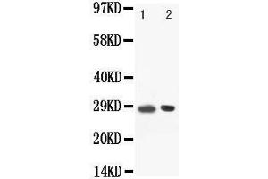 Anti-BOB1 antibody, Western blotting Lane: Rat Spleen Tissue Lysate (POU2AF1 Antikörper  (C-Term))