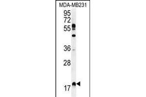 RHEB Antibody (C-term) (ABIN655712 and ABIN2845163) western blot analysis in MDA-M cell line lysates (35 μg/lane). (RHEB Antikörper  (C-Term))
