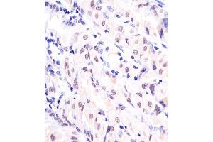 (ABIN6242774 and ABIN6577127) staining EX1 in human stomach sections by Immunohistochemistry (IHC-P - paraformaldehyde-fixed, paraffin-embedded sections). (APEX1 Antikörper)