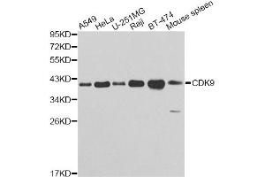 Western blot analysis of extracts of various cell lines, using CDK9 antibody (ABIN5970745) at 1/1000 dilution. (CDK9 Antikörper)