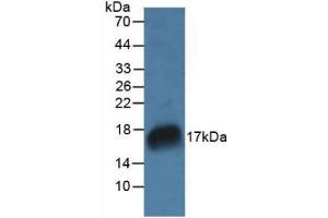 Figure. (RNASE7 Antikörper  (AA 31-155))