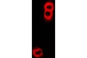 Immunofluorescence (IF) image for anti-Transporter 2, ATP-Binding Cassette, Sub-Family B (MDR/TAP) (TAP2) antibody (ABIN7305990)