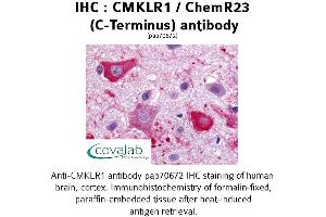 Image no. 1 for anti-Chemokine-Like Receptor 1 (CMKLR1) (C-Term), (Cytoplasmic Domain) antibody (ABIN1733165) (CMKLR1 Antikörper  (C-Term, Cytoplasmic Domain))