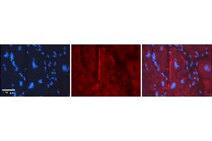 Immunohistochemistry (IHC) image for anti-Gap Junction Protein, gamma 2, 47kDa (GJC2) (Middle Region) antibody (ABIN2774865)