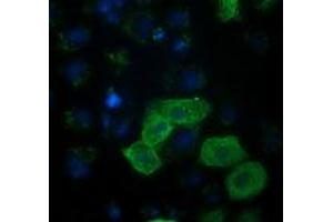 Anti-RASSF1 mouse monoclonal antibody (ABIN2454293) immunofluorescent staining of COS7 cells transiently transfected by pCMV6-ENTRY RASSF1 (RC213525). (RASSF1 Antikörper)