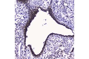 IHC analysis of Cdk6 using anti-Cdk6 antibody (ABIN5692992). (CDK6 Antikörper  (AA 1-326))