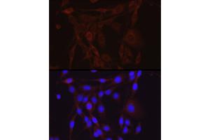 Immunofluorescence analysis of PC-12 cells using SCNN1A Rabbit pAb (ABIN6129465, ABIN6147447, ABIN6147448 and ABIN6221186) at dilution of 1:200 (40x lens). (SCNN1A Antikörper  (AA 105-225))