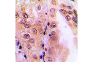 Immunohistochemistry (IHC) image for anti-Protein Phosphatase 2, Regulatory Subunit B', delta (PPP2R5D) (C-Term) antibody (ABIN7301150)
