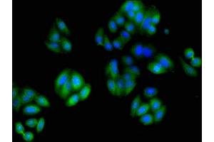 Immunofluorescent analysis of HepG2 cells using ABIN7173663 at dilution of 1:100 and Alexa Fluor 488-congugated AffiniPure Goat Anti-Rabbit IgG(H+L) (TUBA3C Antikörper  (AA 161-418))