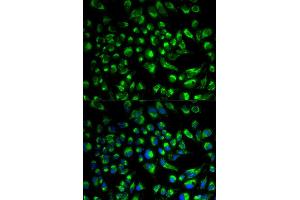 Immunofluorescence analysis of HeLa cell using SPAM1 antibody. (SPAM1 Antikörper)