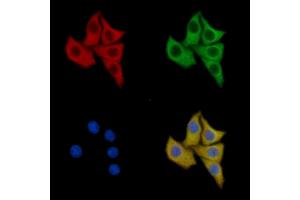 TNF Receptor II Mouse Monoclonal Antibody staining HepG2 cells by IF/ICC.