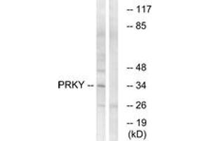 Western blot analysis of extracts from Jurkat cells, using PRKY Antibody. (PRKY Antikörper  (AA 61-110))