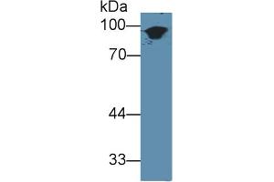 Western Blot; Sample: Mouse Skin lysate; Primary Ab: 3µg/ml Rabbit Anti-Mouse KRT1 Antibody Second Ab: 0. (Cytokeratin 1 Antikörper  (AA 189-497))