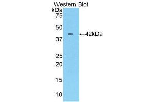 Western Blotting (WB) image for anti-Carboxypeptidase B2 (Plasma) (CPB2) (AA 113-422) antibody (ABIN1860677) (CPB2 Antikörper  (AA 113-422))
