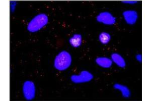 Immunofluorescence (IF) image for anti-ADAM Metallopeptidase Domain 17 (ADAM17) (AA 215-315) antibody (ABIN614668)