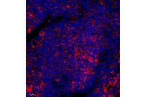 Immunofluorescence of paraffin embedded human tonsil using BTBD6 (ABIN7073235) at dilution of 1:50 (400x lens) (BTBD6 Antikörper)