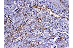 IHC analysis of VEGF Receptor 3 using anti-VEGF Receptor 3 antibody . (FLT4 Antikörper)