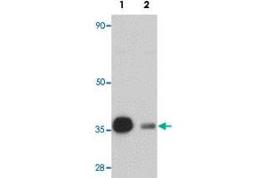 Western blot analysis of rat heart tissue with REEP3 polyclonal antibody  at 1 ug/mL in (Lane 1) the absence and (Lane 2) the presence of blocking peptide. (REEP3 Antikörper  (C-Term))