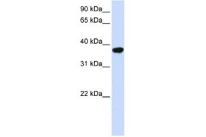 ICMT antibody used at 1 ug/ml to detect target protein. (ICMT Antikörper  (Middle Region))