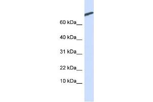 WB Suggested Anti-ARPP-21 Antibody Titration:  0. (ARPP21 Antikörper  (N-Term))