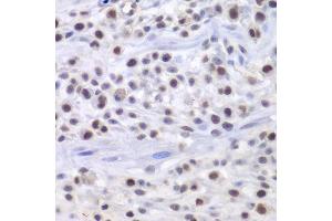 Immunohistochemistry of paraffin-embedded mouse osteosarcoma using HAT1 antibody.