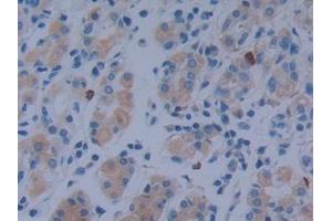 DAB staining on IHC-P; Samples: Human Stomach Tissue (MACC1 Antikörper  (AA 522-784))