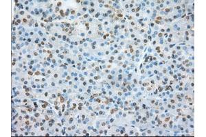 Immunohistochemical staining of paraffin-embedded colon tissue using anti-ERCC1 mouse monoclonal antibody. (ERCC1 Antikörper)