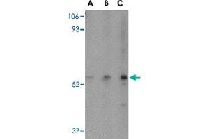 Western blot analysis of SP110 in HeLa cell lysate with SP110 polyclonal antibody  at (A) 0. (SP110 Antikörper  (C-Term))