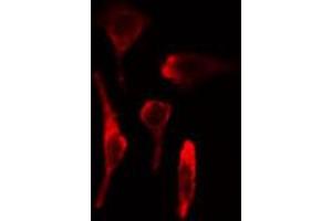 ABIN6269324 staining HeLa cells by IF/ICC.