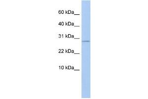 WB Suggested Anti-ANKRD7 Antibody Titration: 0. (ANKRD7 Antikörper  (Middle Region))