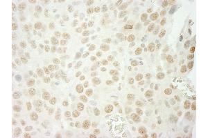 Immunohistochemistry (IHC) image for anti-U2 Small Nuclear RNA Auxiliary Factor 1 (U2AF1) (AA 140-190) antibody (ABIN7448845) (U2AF1 Antikörper  (AA 140-190))