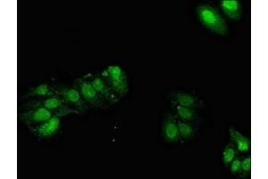 Immunofluorescent analysis of HepG2 cells using ABIN7154072 at dilution of 1:100 and Alexa Fluor 488-congugated AffiniPure Goat Anti-Rabbit IgG(H+L) (Glutathione Peroxidase 2 Antikörper  (AA 71-168))